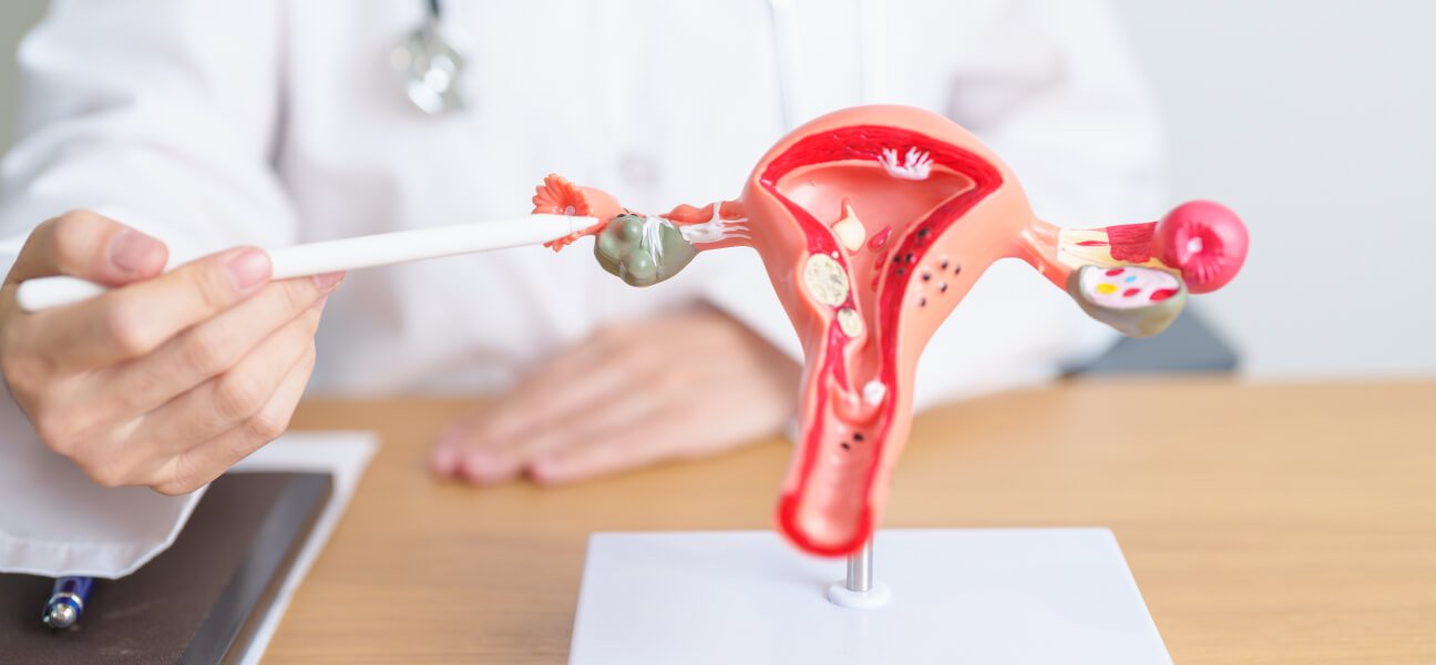 Gynecology